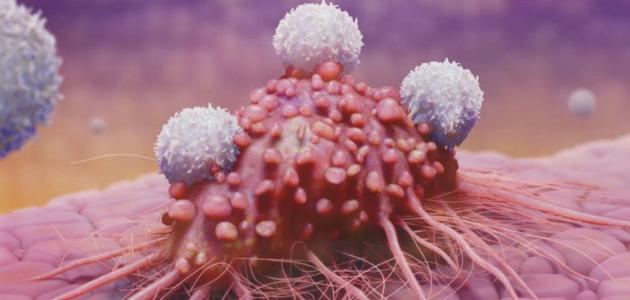 بحث عن مرض السرطان مع المراجع