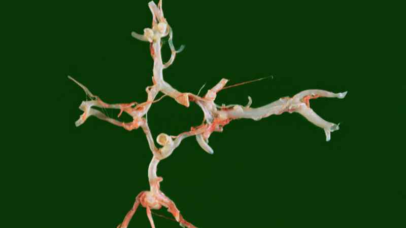 تمدد الأوعية الدموية الأبهري البطني: العلاج المفتوح والعلاج طفيف التوغل